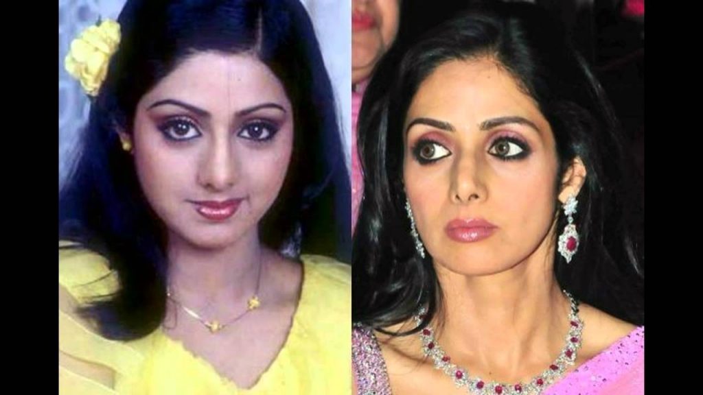Sridevi before and after facial therapies 